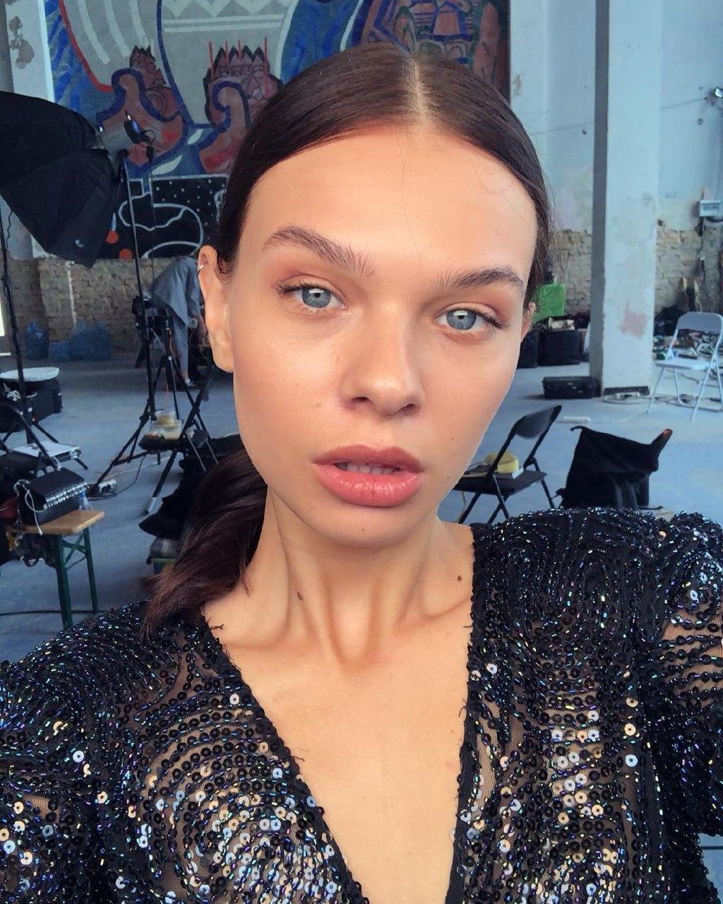 Как ухаживать за проблемной кожей: секреты участницы "Супермодели по-украински"